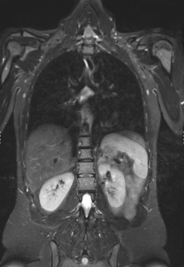 MRTGanzkoerper Koerperstamm