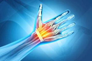 AdobeStock Arthrose der Handgelenke