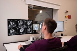 Beyond Imaging Kardio MRT
