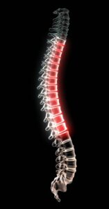 wirbelsäule brustwirbelsäule BWS schmerz wirbelsäule brustwirbelsäule BWS schmerz