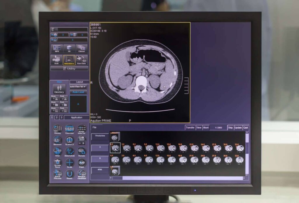 MRT Abdomen MRT Abdomen