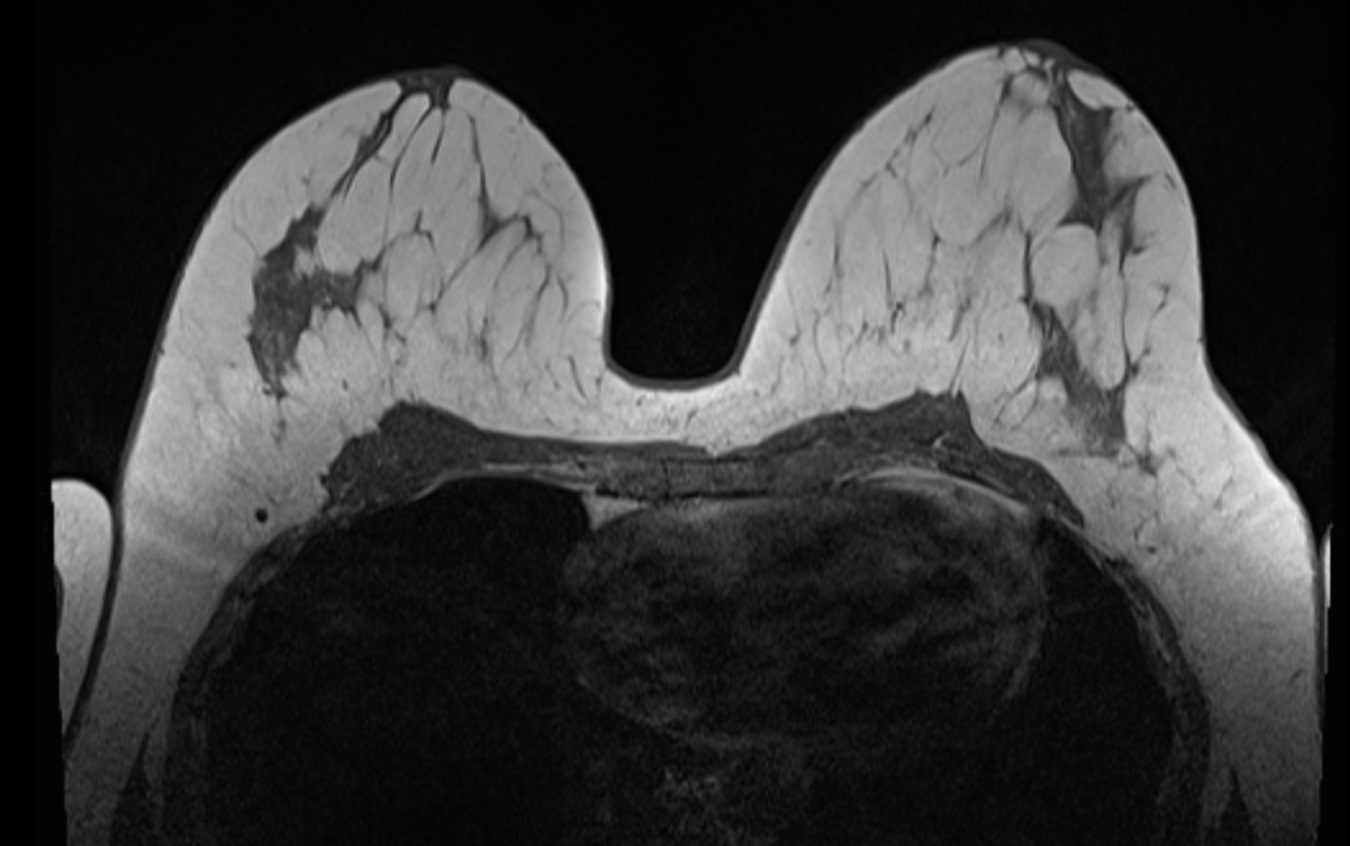 AiraMed AiraScore Beyond Imaging Patientin