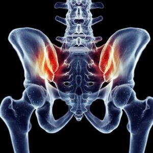 SI joint pain liebscher bracht