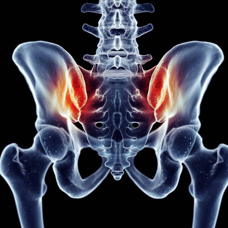 SI joint pain liebscher bracht