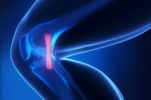 Team Sports Injuries healthy Medial Collateral Ligament px