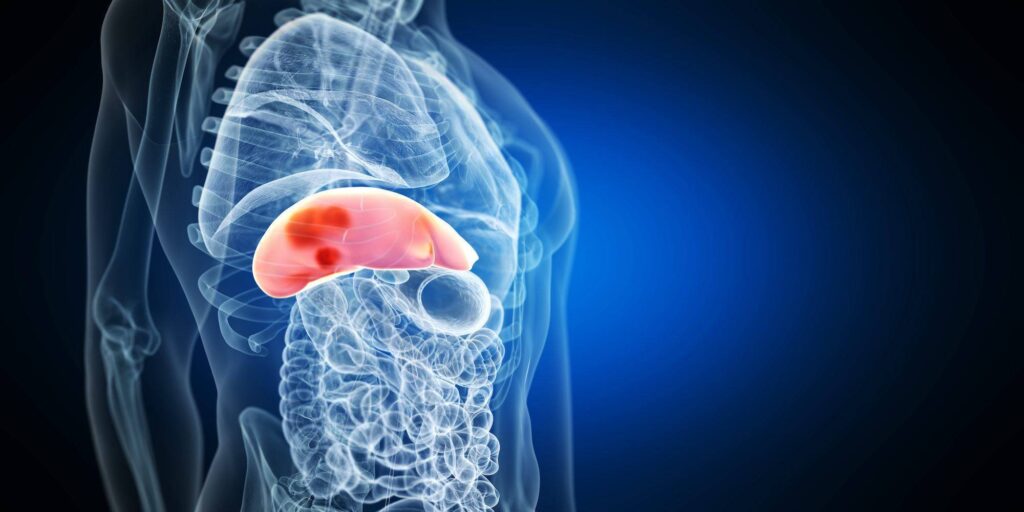 leberkrebs leberkrebs