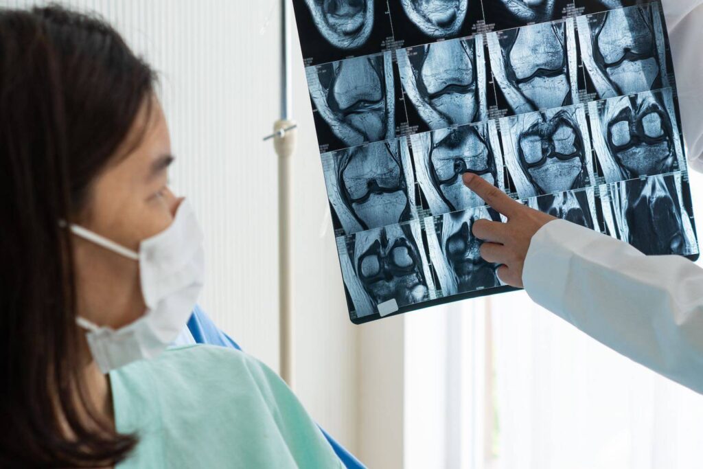 meniskusschaden meniskusschaden